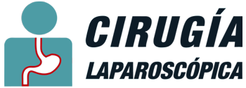 Cirugía Laparoscópica, Cirugía Gastroenterología, Hendad, Toluca, Metepec, México, Cirujano Laparoscopista, Especialista Gastroenterología, Cirugía de Vesícula, Hernias Abdominales, Cirugía de Hemorroides, Dolor Abdominal, Enfermedades Digestivas, Salud Digestiva, Cirugía laparoscópica de vesícula Toluca,  Colecistectomía laparoscópica recuperación, Extracción de cálculos biliares sin cirugía, Costo cirugía vesícula Toluca, Síntomas de cálculos en la vesícula, Corrección de hernia inguinal con malla Toluca, Cirugía hernia umbilical laparoscópica, Recuperación cirugía hernia incisional, Diástasis de rectos abdominales tratamiento quirúrgico, Cirujano especialista en hernias Toluca, Qué es una hernia postincisional y cómo se corrige, Cirugía de hemorroides internas y externas Toluca, Hemorroidectomía sin dolor, Tratamiento avanzado para hemorroides, Recuperación después de cirugía de hemorroides, Laparoscopia diagnóstica para dolor abdominal crónico, Lisis de adherencias intestinales laparoscópica, Abdominoplastia con corrección de diástasis, Cirugía mínimamente invasiva abdomen, Beneficios de la cirugía laparoscópica, Mejor cirujano gastro Toluca, Clínica especializada en gastroenterología y cirugía, Cita con especialista en cirugía digestiva, Atención integral para problemas digestivos, Opciones de tratamiento para dolor abdominal inexplicable