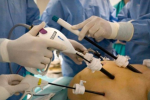 LAPAROSCOPÍA DIAGNÓSTICA